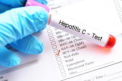 Hepatitis, una enfermedad silenciosa